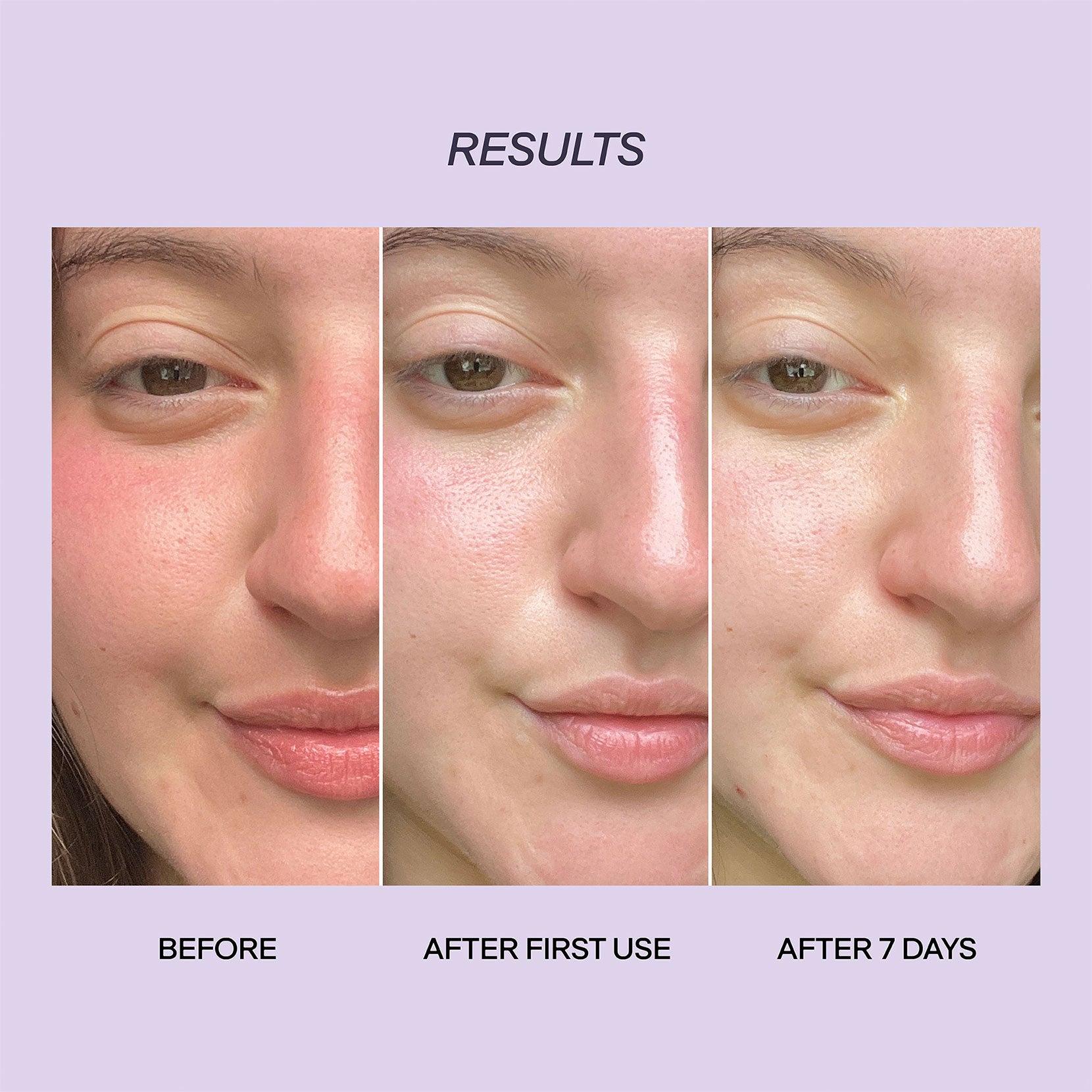 BARE LUMIÈRE Barrier Repair Cream